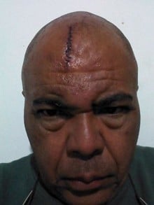 Jornalista de Itabirito denuncia agressão