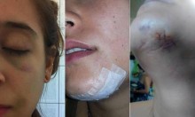 Universitárias são assediadas e agredidas em república de Ouro Preto após rejeitarem agressor